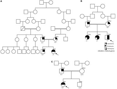 A founder COL4A3 pathogenic variant resulting in Alport syndrome and thin basement membrane disease: a case report series